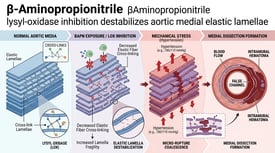 β-Aminopropionitrile βAminopropionitrile lysyl-oxidase inhibition destabilizes aortic medial elastic lamellae